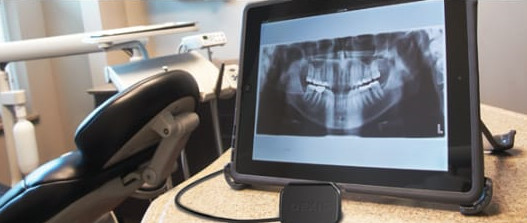 Digital x-rays